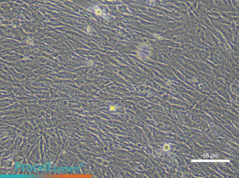 Human Adipose-derived Mesenchymal Stem (Primary cell immortalization) Cell Complete Medium - 5