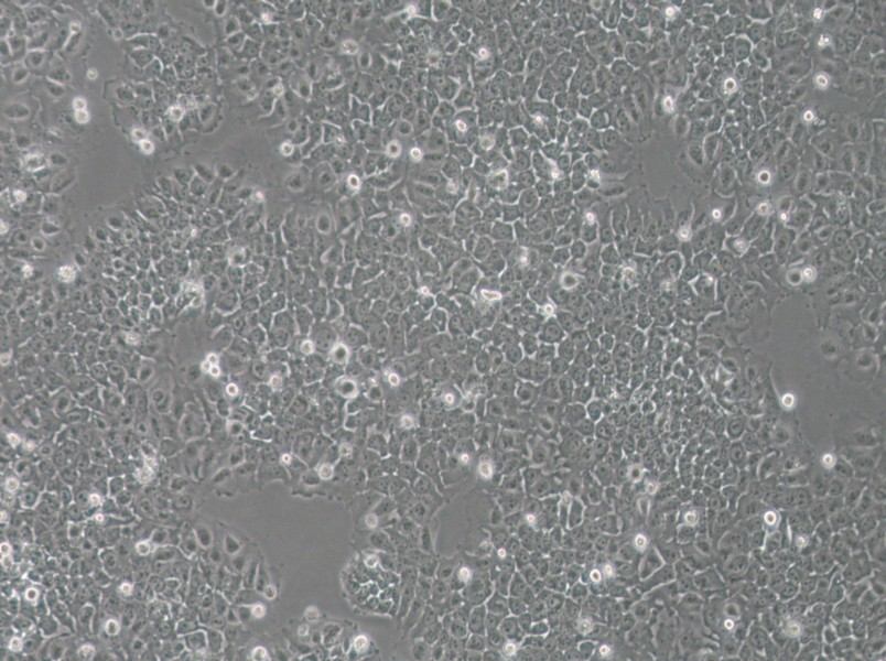 SACC-83 Cell Complete Medium - small - 2
