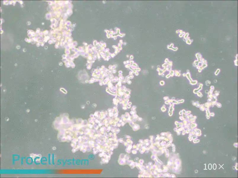 DU4475 Cell Complete Medium - 3