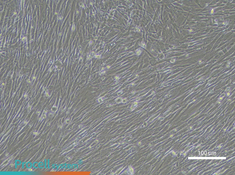 Human Pulmonary Arteriolar Smooth Muscle Cell Complete Medium - 1