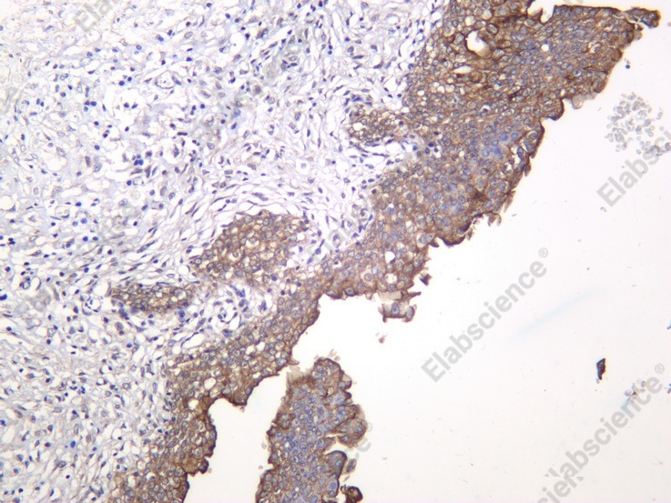 Recombinant Uroplakin III Monoclonal Antibody - 1