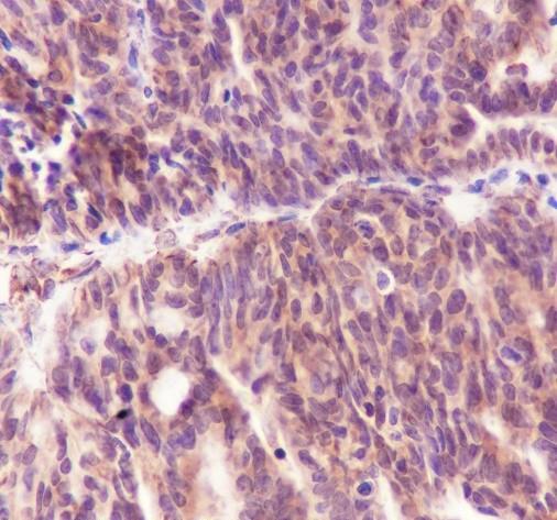 Recombinant Cyclin D2 Monoclonal Antibody - small - 3