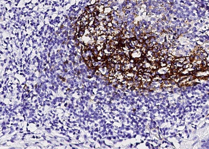 Recombinant CD23/FCER2 Monoclonal Antibody - small - 3