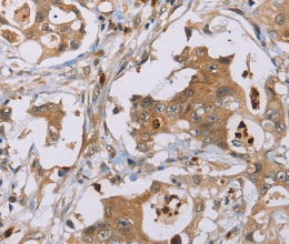 OTC Polyclonal Antibody - 2