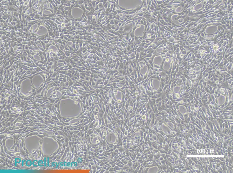 YUMM1.1 Cell Complete Medium - 1