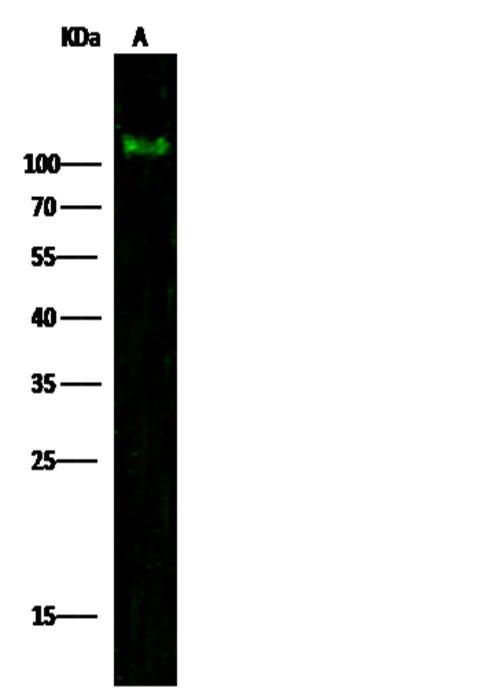 PDGFRA/CD140a Monoclonal Antibody - small - 1
