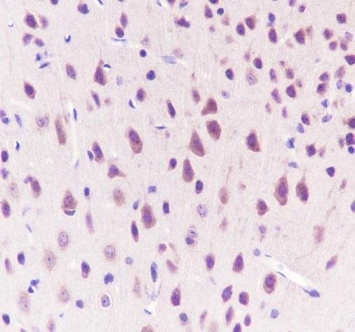 Recombinant KIR3DL1 Monoclonal Antibody - small - 3