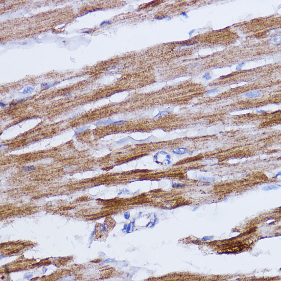 Immunohistochemistry of paraffin-embedded Rat heart using NDUFB7 Polyclonal Antibody at dilution of  1:100 (40x lens).