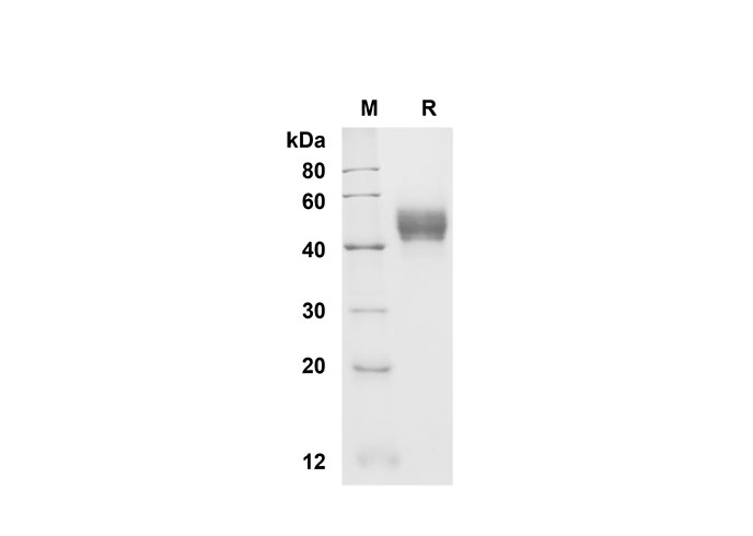 Recombinant Human IL15 Protein-产品推荐-1