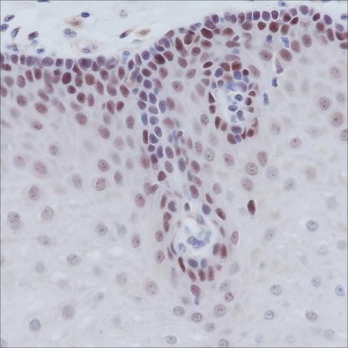 Recombinant MSH2 Monoclonal Antibody - small - 2