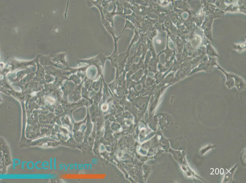 HCC70 Cell Complete Medium - small - 6