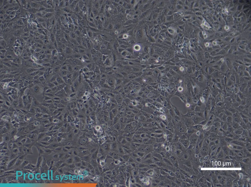 Human Type II Alveolar Epithelial (Primary cell immortalization) Cell Complete Medium - 9