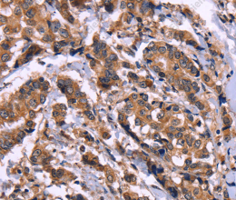 AMIGO2 Polyclonal Antibody - 3