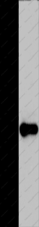 ADO Polyclonal Antibody - 1