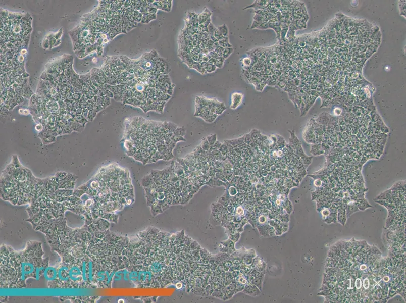 BT-474 [BT474] Cell Complete Medium - 3