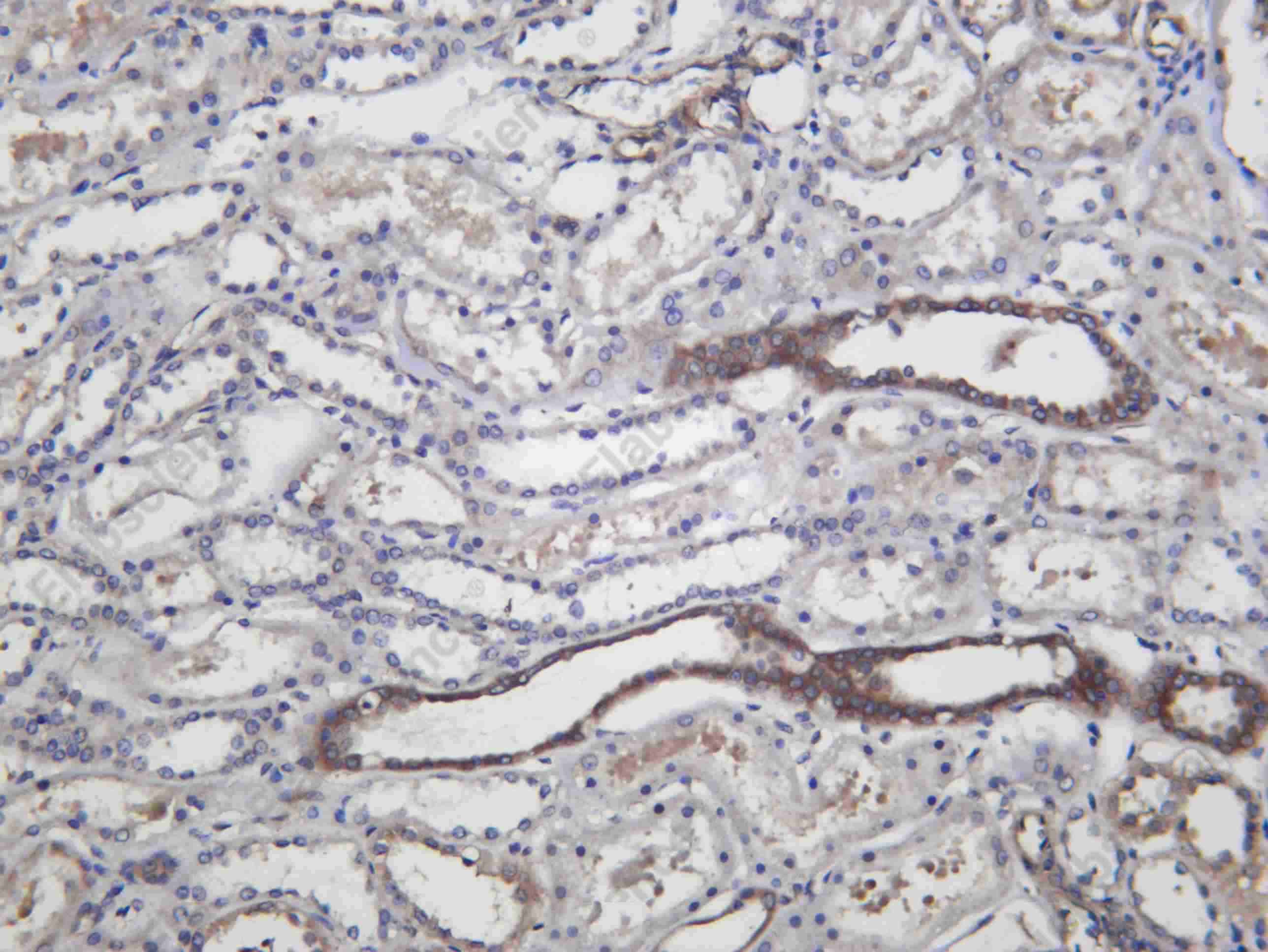 Recombinant KINH Monoclonal Antibody - 1
