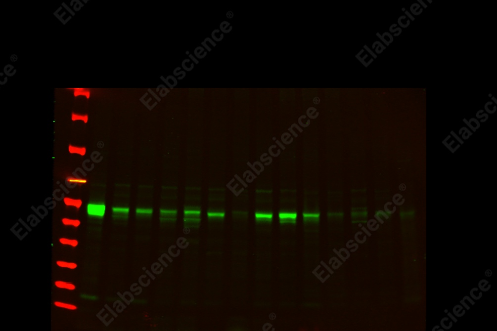 Recombinant TGF β1 Monoclonal Antibody - 1