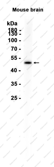 Recombinant Perilipin-2 Monoclonal Antibody - 1