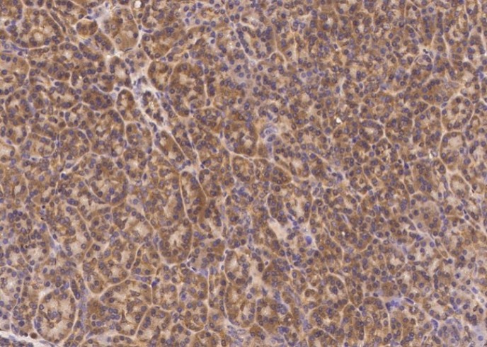 Recombinant PMVK/phosphomevalonate kinase Monoclonal Antibody - small - 2