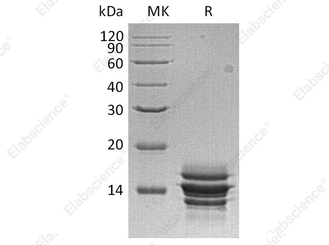 Recombinant Human CXCL7/NAP-2 Protein (His Tag) - 1