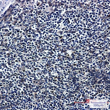 Recombinant RanGAP1 Monoclonal Antibody - 4