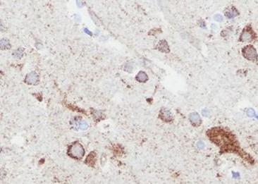 Recombinant eIF4A2 Monoclonal Antibody-searchlist-3