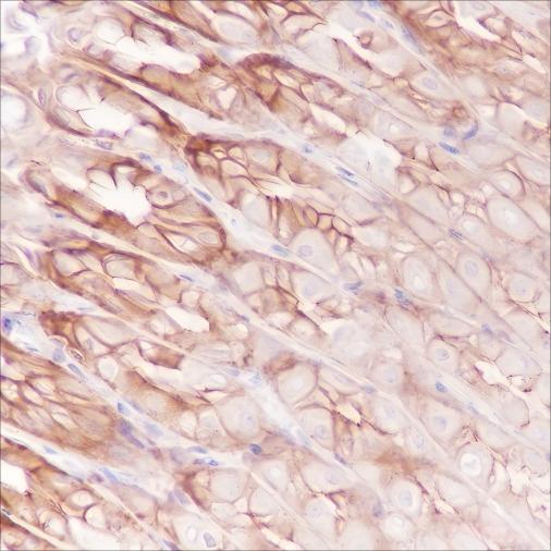 Recombinant FGFR2 Monoclonal Antibody - 3