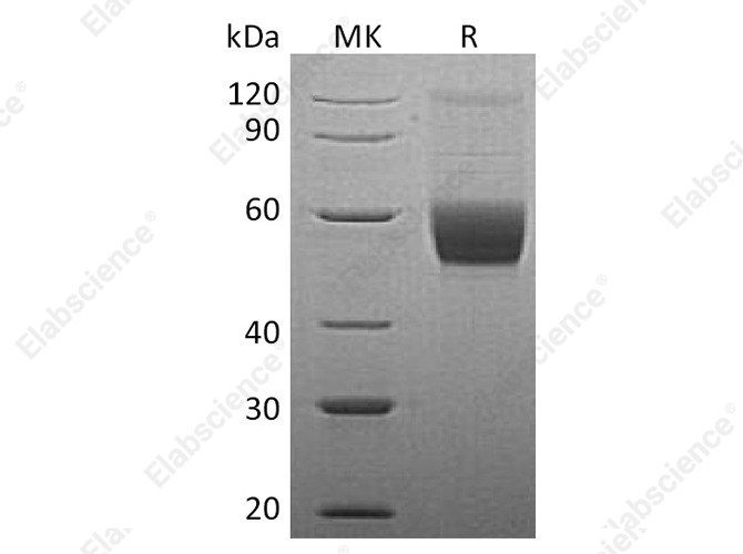 Recombinant Human Vaspin/SerpinA12 Protein (His Tag) - 1
