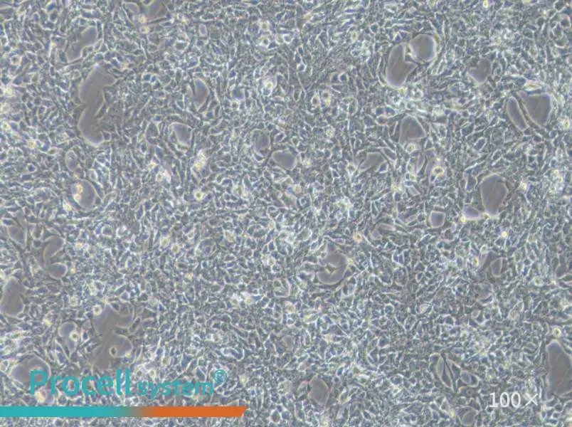 SBC-3 Cell Complete Medium - 1
