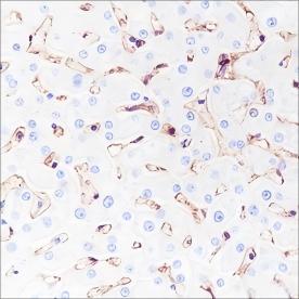 Recombinant MHC Class I Monoclonal Antibody - 2