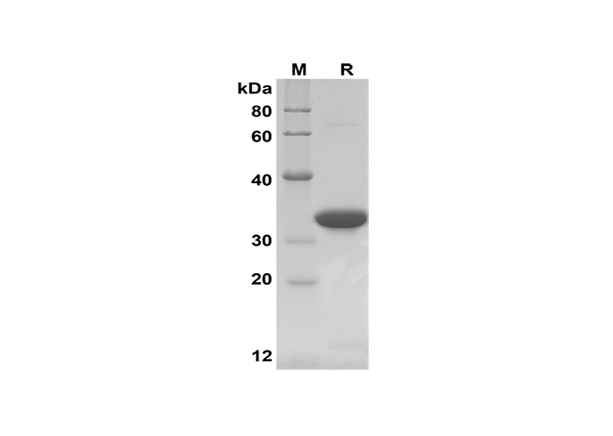 Recombinant Human IL15 Protein-产品推荐-1
