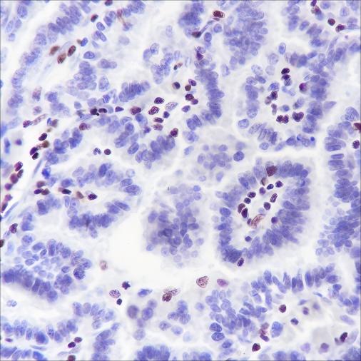 Recombinant IKAROS Monoclonal Antibody - small - 3