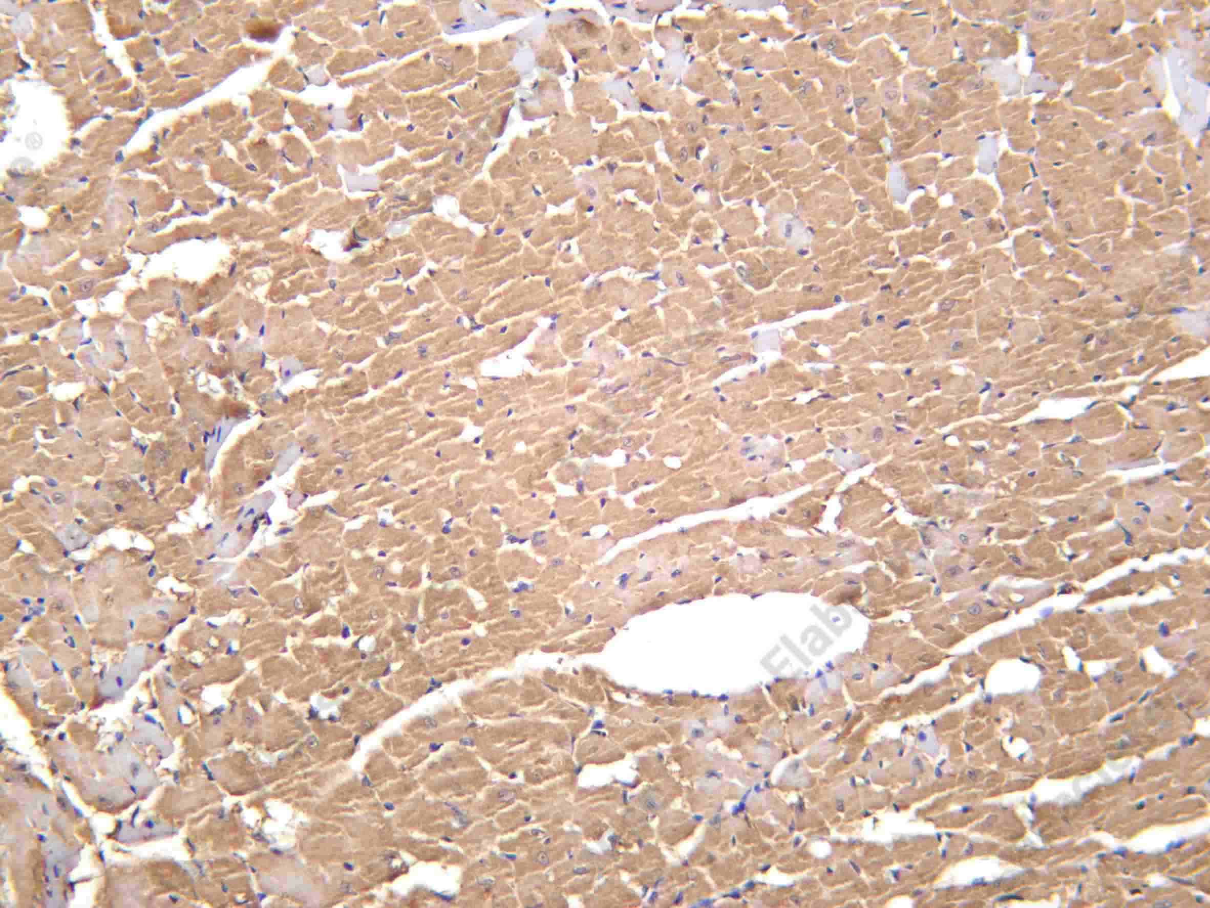 Recombinant alpha 1a Adrenergic Receptor Monoclonal Antibody - 3
