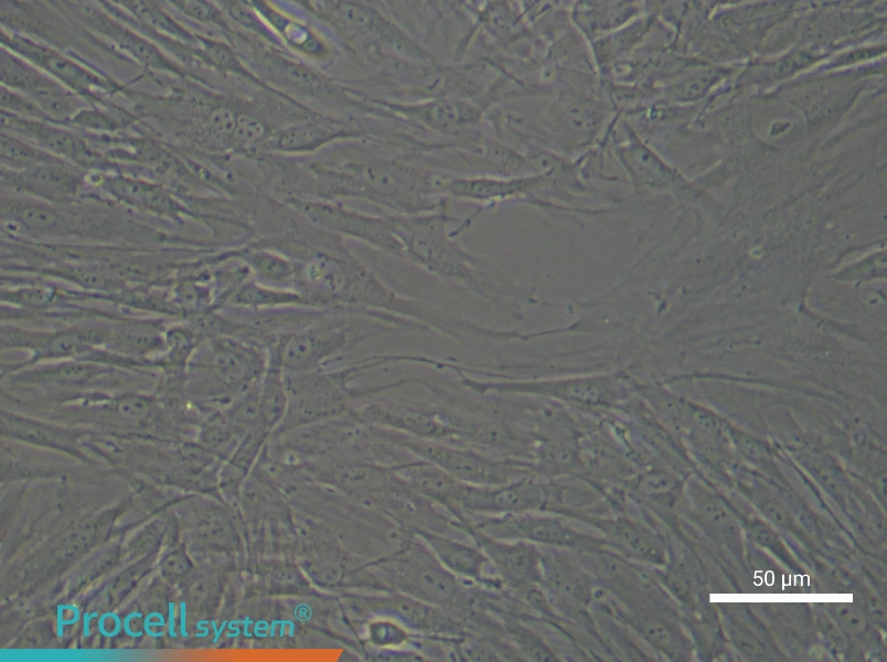 Human Esophageal Cancer Fibroblast Complete Medium - 4