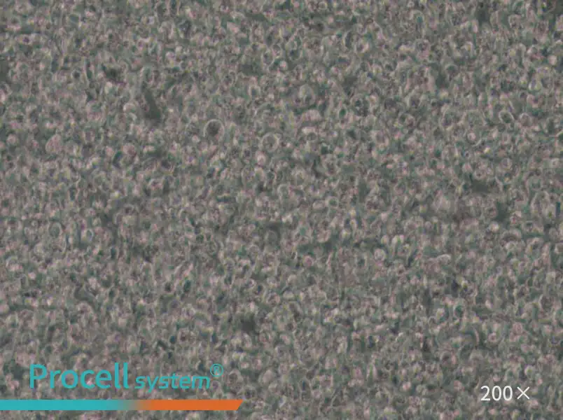 SU-DHL-1 Cell Complete Medium - small - 5