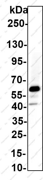 Recombinant TNF-R2 Monoclonal Antibody - 1
