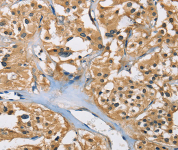 PPP3CA Polyclonal Antibody - 2