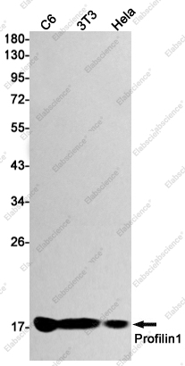 Recombinant Profilin 1 Monoclonal Antibody - 1