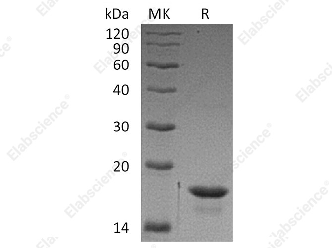 Recombinant Human 4E-BP1/EIF4EBP1 Protein (His Tag) - 1