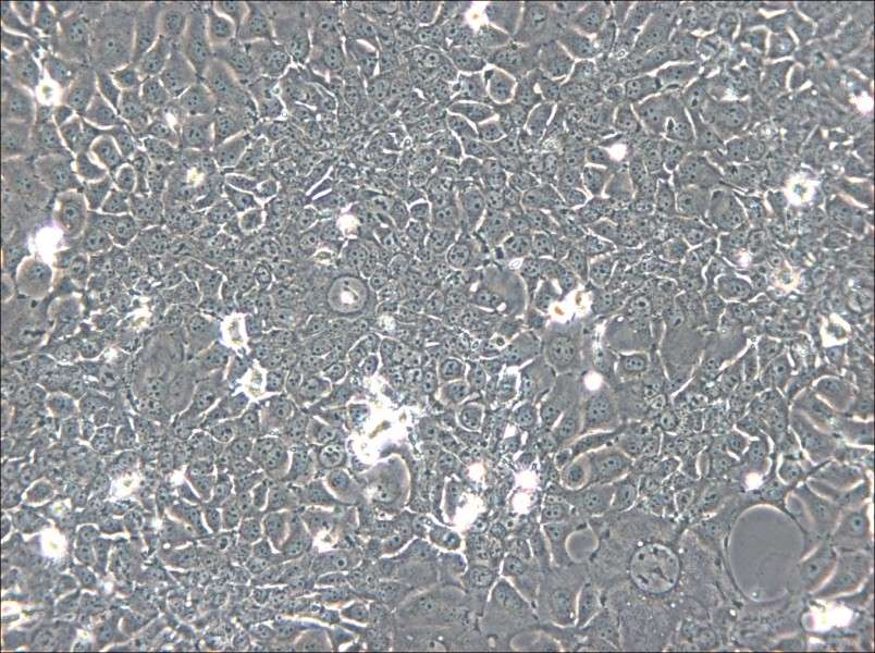 KYSE-140 Cell Complete Medium - 5