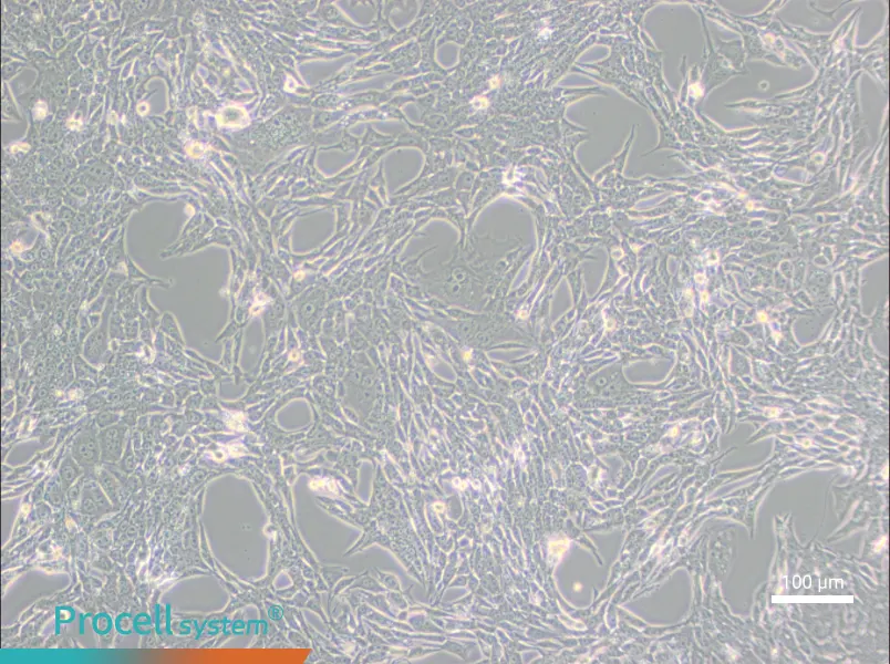 Renca [RenCa] Cell Complete Medium - 1