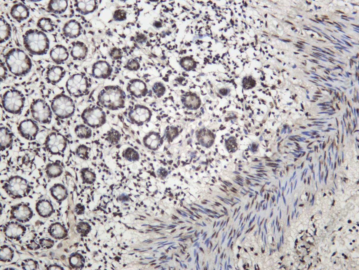 Recombinant Histone H4 (Acetyl Lys12) Monoclonal Antibody - 1