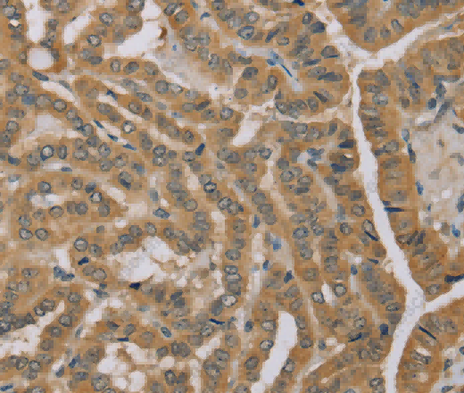 MVK Polyclonal Antibody - 2
