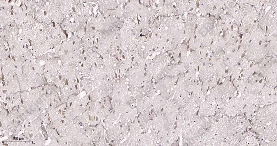 Recombinant FXR1 Monoclonal Antibody - 2