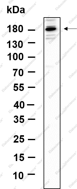 Recombinant TIAM2 Monoclonal Antibody - 1