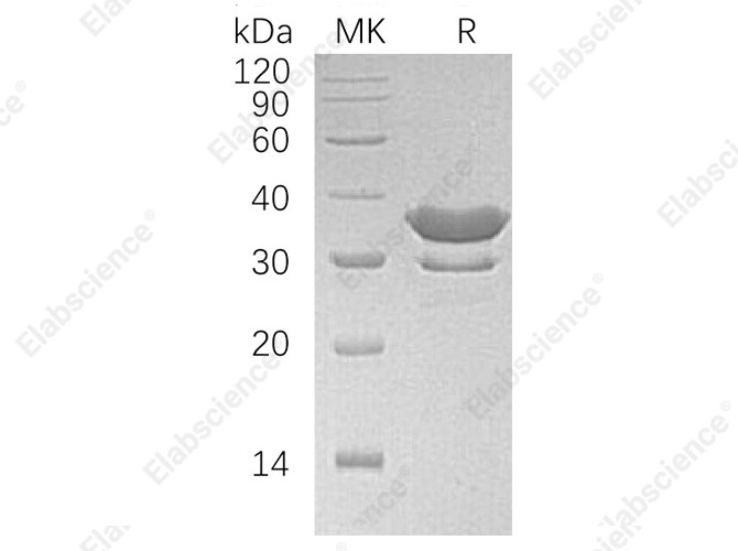 Recombinant Human SULT2A1 Protein (His Tag) - 1