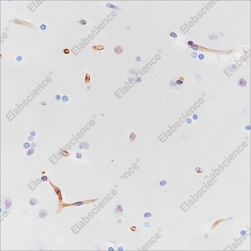 Recombinant Nestin Monoclonal Antibody - 1