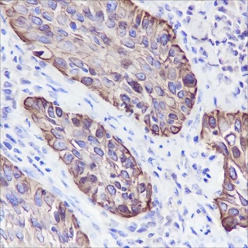 Recombinant Keratin 5/6 Monoclonal Antibody - small - 2