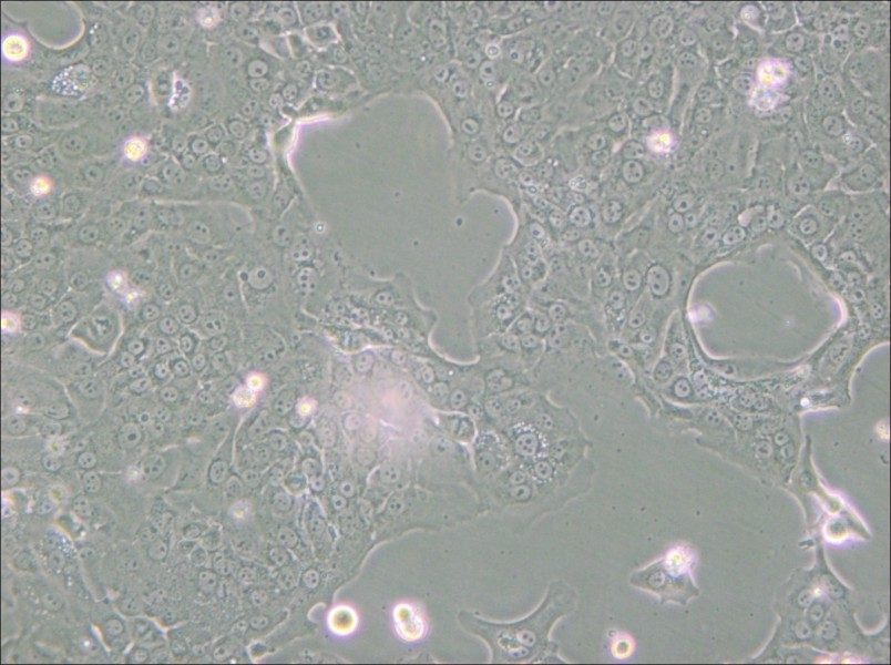 Capan-1 Cell Complete Medium - small - 5