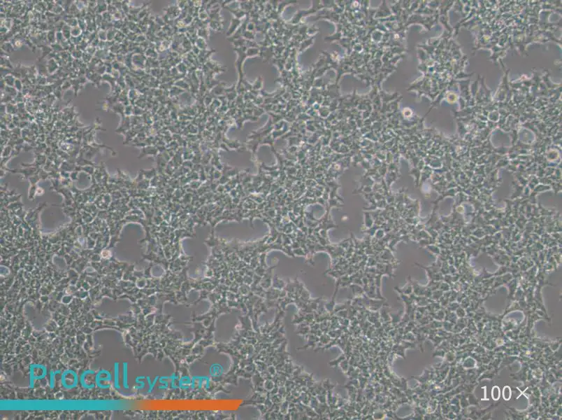 NCCIT Cell Complete Medium - 1